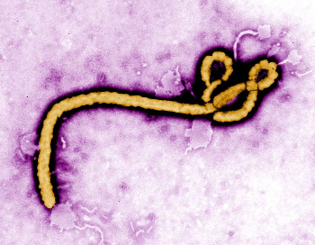 Micrografía teñida del virus del Ébola