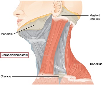 esternocleidomastoideo