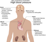 Complicación de la hipertensión