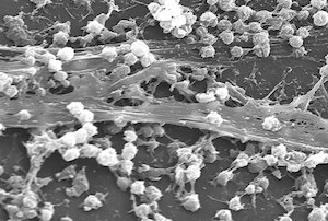 Biopelícula de Staphylococcus aureus