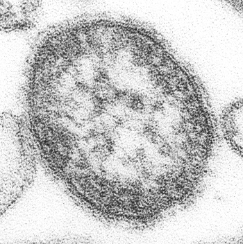 Virus del sarampión