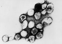 Virus de la rubéola bajo un microscopio