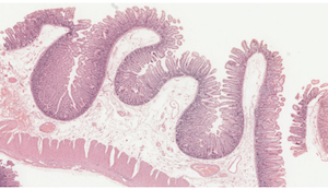 sección del intestino