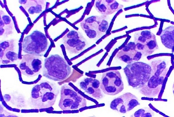 gramstain1