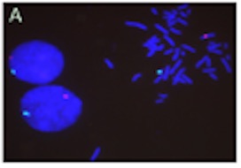 Hibridación fluorescente in situ: el ARN se marca con sondas fluorescentes