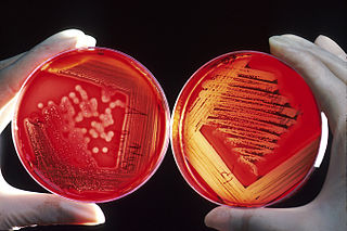 Esto muestra una placa de agar rosa con microorganismos creciendo.