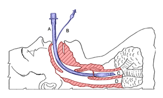 Diagrama de tubo de respiración