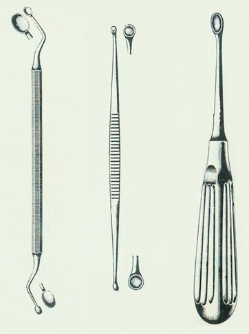 Curetas utilizadas en desbridamiento quirúrgico.