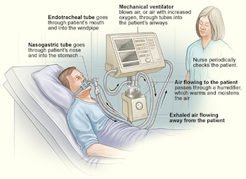 Ventilador