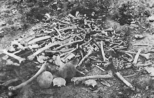 imagen de restos humanos