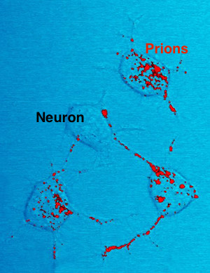 priones