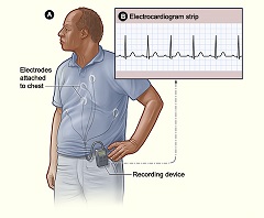 Monitor holter