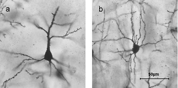 neurona cerebral