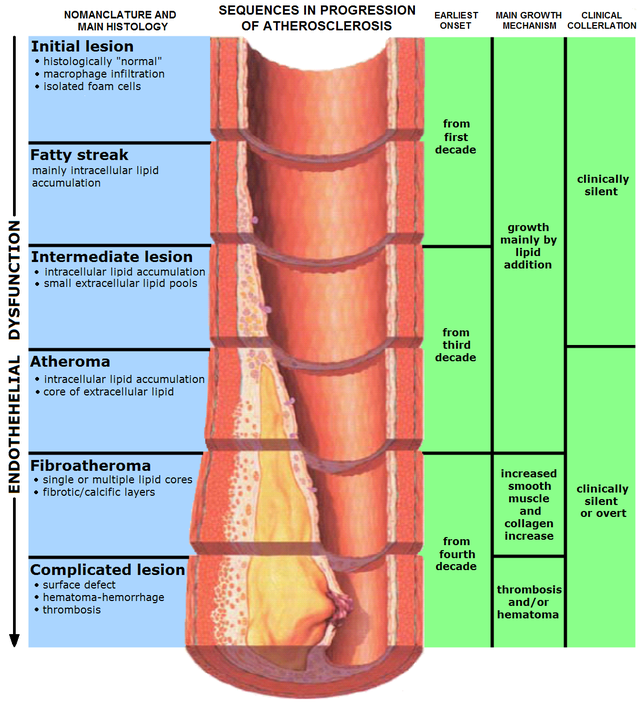 progresión de la aterosclerosis