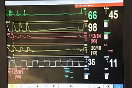 Controle los signos vitales durante el procedimiento