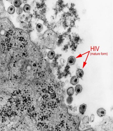 VIH que infecta células humanas
