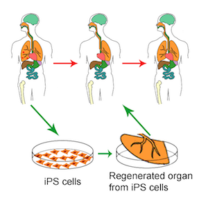 iPSC