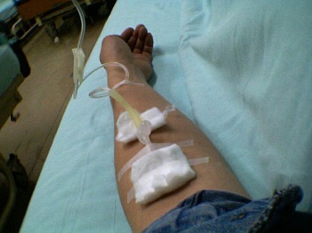 IV