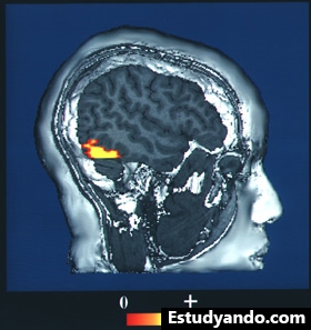 Resonancia magnética funcional utilizada para identificar la actividad cerebral