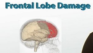 Daño del lóbulo frontal