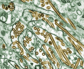 Cómo se ve el H5N1 bajo el microscopio