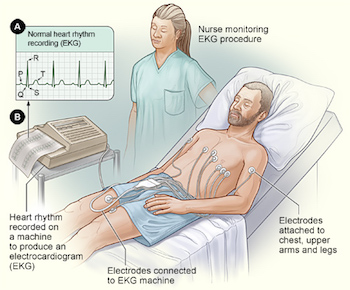 Electrocardiograma