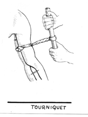 Un torniquete en uso.