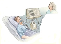 La succión debe realizarse en pacientes con un tubo endotraqueal.