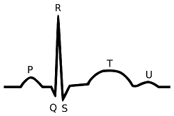 forma de onda del corazón