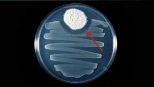 Diapositiva de penicillium del amonalismo