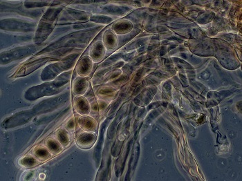 Ascosporas