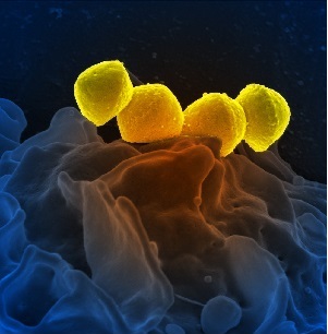 A. strectococcus