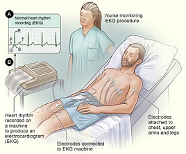 Electrocardiograma