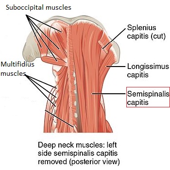 semiespinal