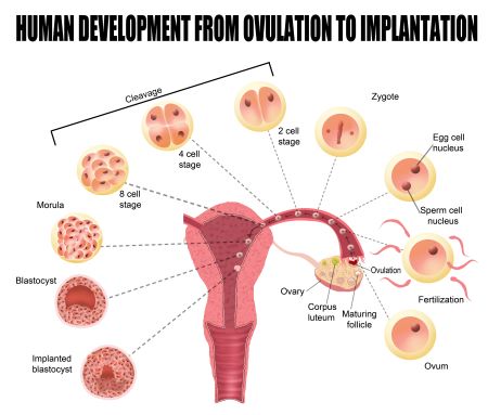 implantación