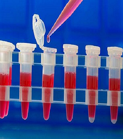 Una representación de los plásticos utilizados en equipos de laboratorio; aquí se muestran los pequeños viales utilizados para los experimentos.
