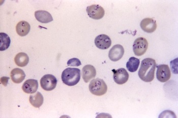babesia