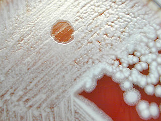 Colonias de B. anthracis