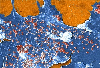 Las bacterias están en todas partes, y la mayoría de ellas son perfectamente seguras.