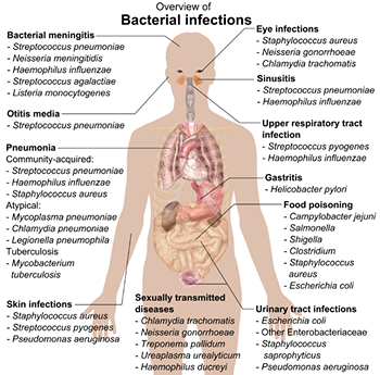 Algunos tipos de bacterias pueden causar infecciones.