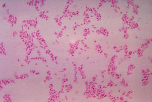 Tinción de Gram para Bacteroides fragilis