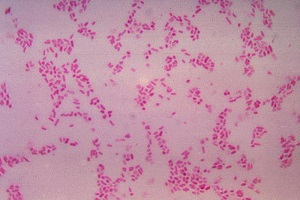 Ejemplo de bacterias gramnegativas
