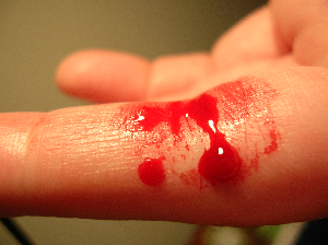 Imagen de un dedo sangrando