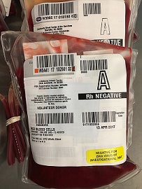 Sangre que se devuelve al paciente
