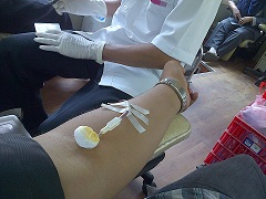 La sangre se puede donar con anticipación para su uso durante la cirugía.