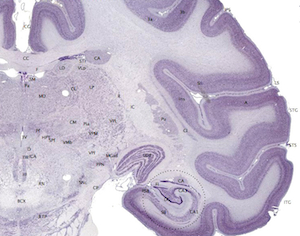 sección transversal del cerebro