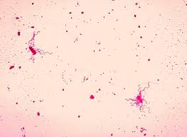 Clostridium novyi