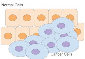 Células cancerígenas