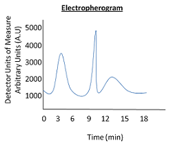 Ejemplo de electroferograma