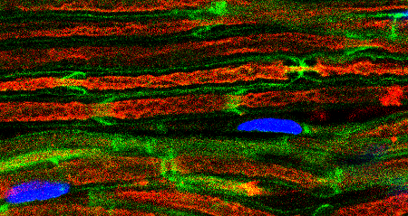 Micrografía histológica que muestra nervios cubiertos por vainas de mielina verde y núcleo de células de Schwann en azul